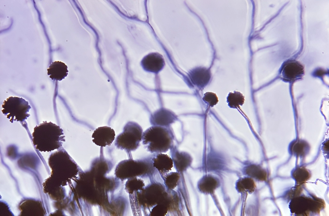 A photo taken from a microscope of black mold better known as aspergillus niger