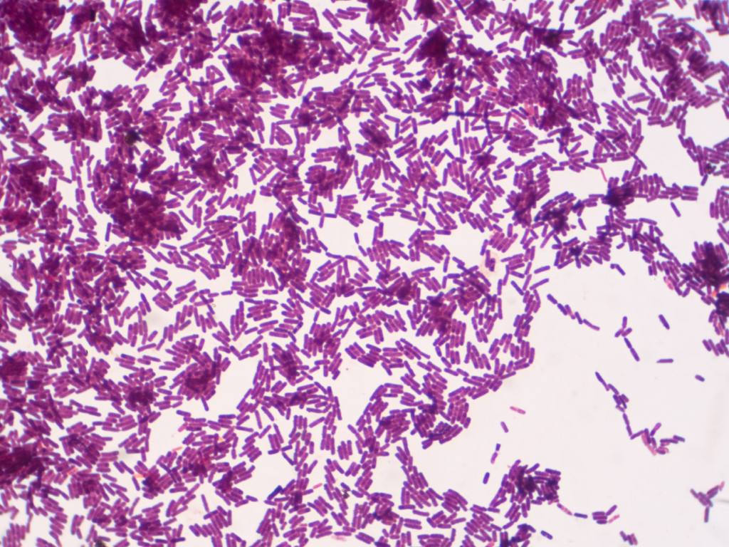 Bacillus Giobigil under a microscope.